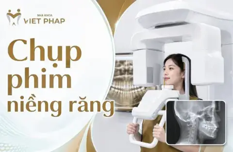 Kiến thức niềng răng – chup phim nieng rang