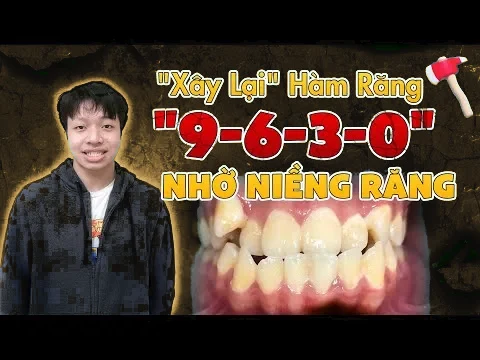 Video cảm nhận khách hàng niềng răng cùng bác sĩ Quỳnh